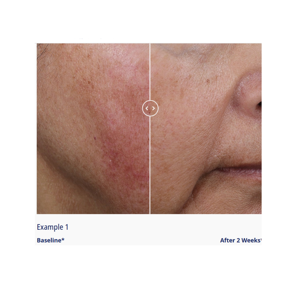 Suzan Obagi Super Antioxidant Serum (PRE-ORDER)